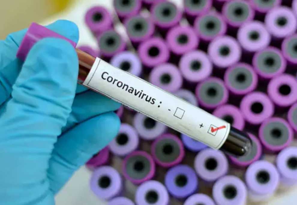 Si të kuptoni nëse jeni prekur nga koronavirusi apo jo