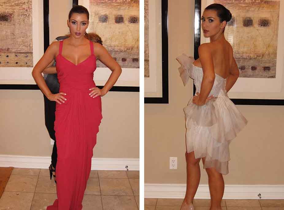 Kim Kardashian publikon foto para ndërhyrjeve
