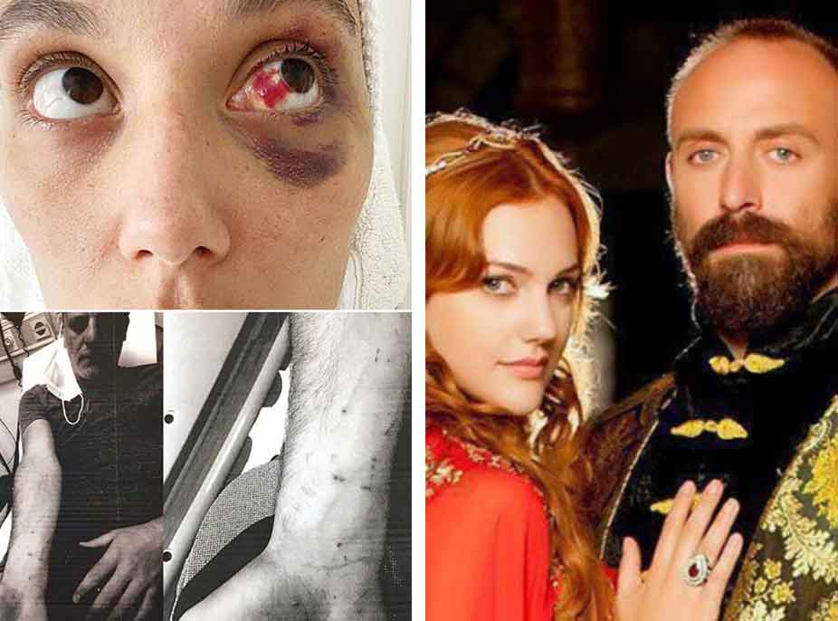 “Më shtriu në krevat, u ul sipër meje e filloi të më godiste”- Aktori i “Sulejmanit të Madhërishëm” dhunon brutalisht të dashurën: Edhe ajo më rrahu mua
