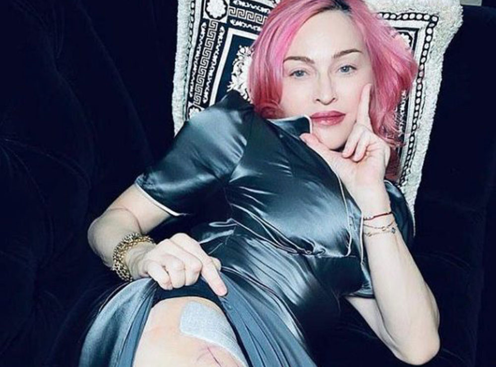 Madonna, muskuj dhe shenja operacionesh: 62 vjeçarja mbetet pa komplekse