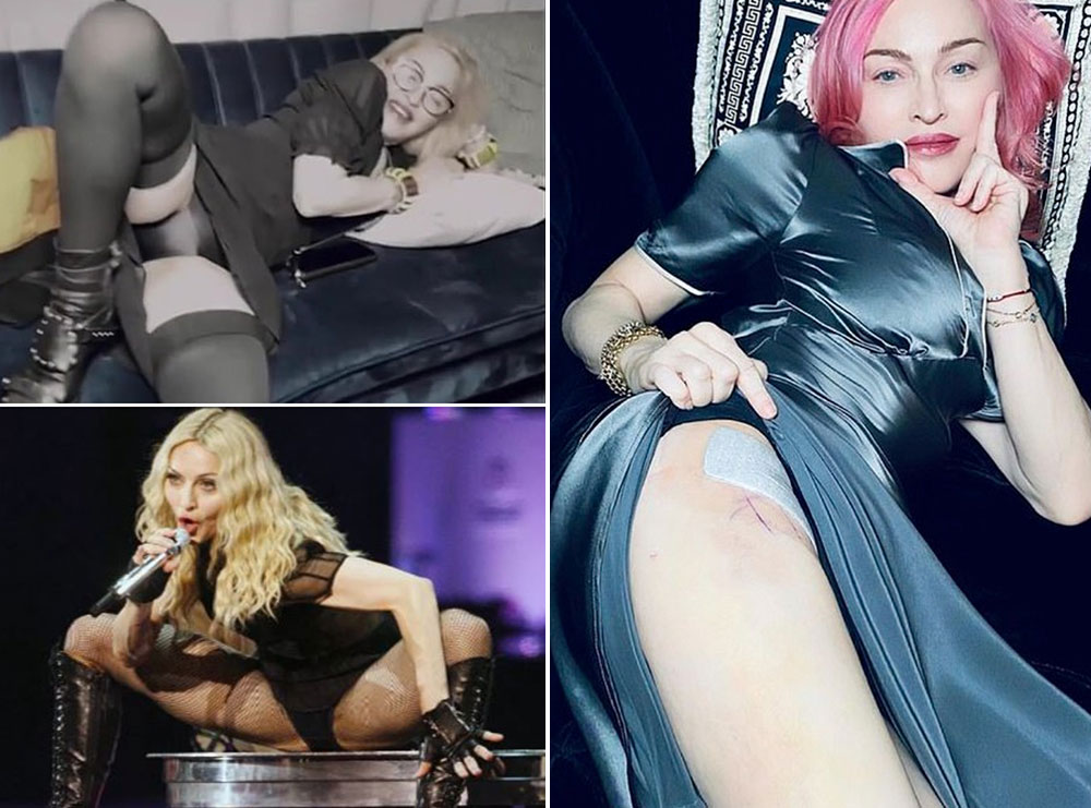 “Gjak, djersë dhe lot”- Madonna vendos të publikojë një dokumentar që tregon jetën e këngëtares në prapaskenë gjatë turneut “Madame X”