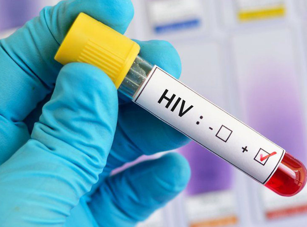 Studimi befasues në Kongo/ Shpresë për zbulimin e ilaçit kundër HIV-AIDS
