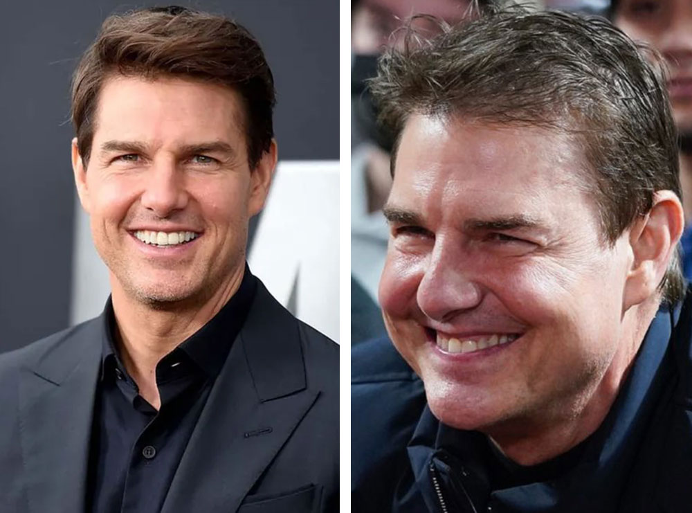 Rrjetet sociale po shpërthejnë nga komentet mbi fotot e Tom Cruise: Mos ka bërë filler?