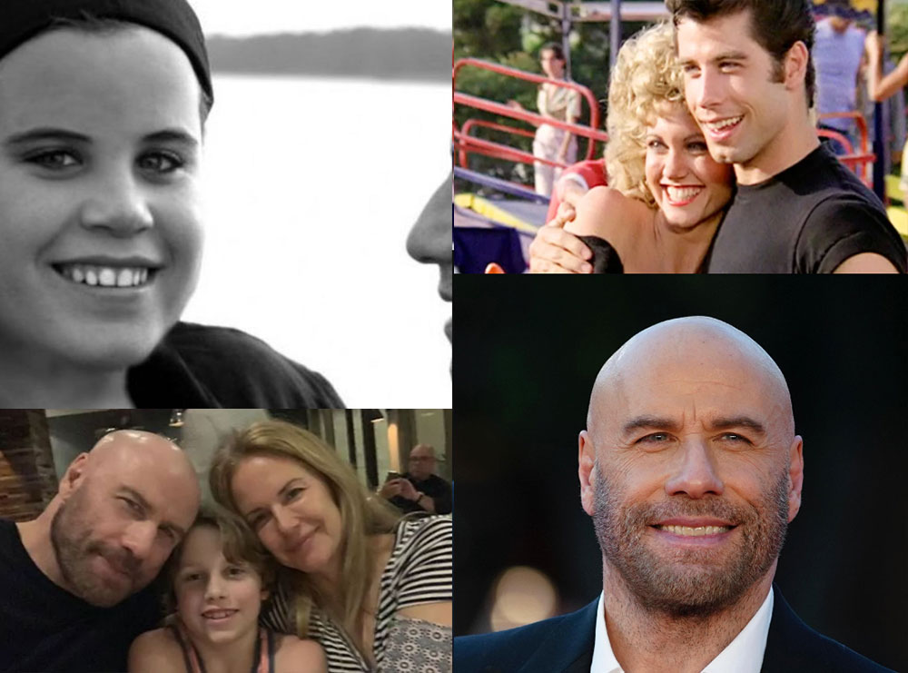 Nga i biri te gruaja, e dashura e para shumë viteve dhe Olivia Newton-John: John Travolta ka humbur 4 njerëzit më të rëndësishëm nga kanceri