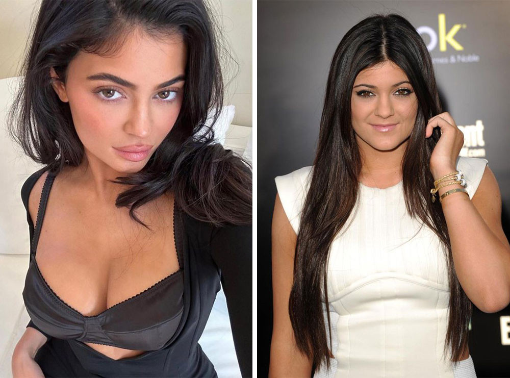 Kylie Jenner shfaqet e penduar për ndërhyrjet estetike që ka bërë