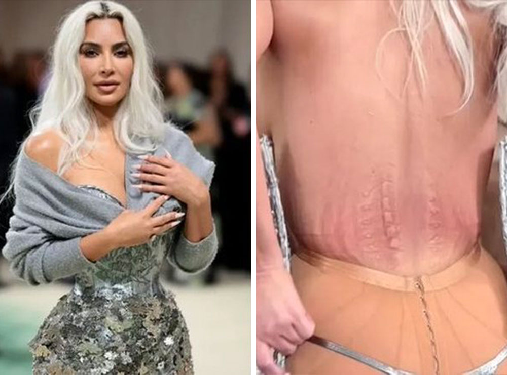 Kim Kardashian tregon se sa e dhimbshme është të veshësh korse dhe të jesh pjesë e Met Gala