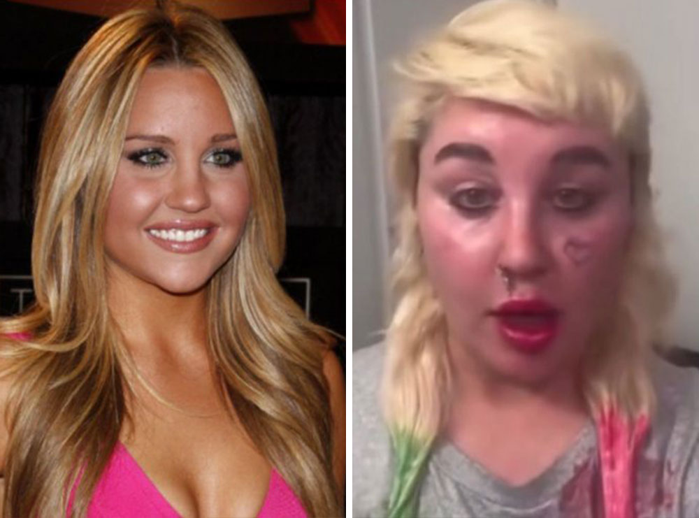Dikur yll i filmave komedi – Ç’ka ndodhur me Amanda Bynes?